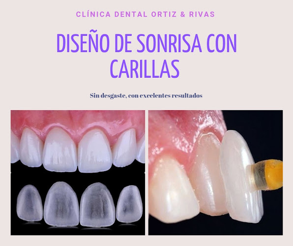 Clínica Dental Ortiz Rivas - Dentista
