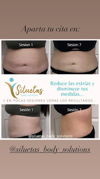 Siluetas body solutions - Photo 7 - Car repair in Kissimmee, FL, Kissimmee