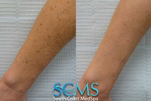 South Coast MedSpa image