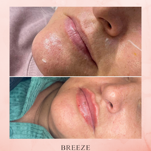 Comments and reviews of Breeze Aesthetics