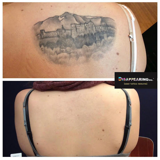 Explore tattoo ideas for pisces, creative tattoo ideas in Mineola, available at Removery Tattoo Removal & Fading