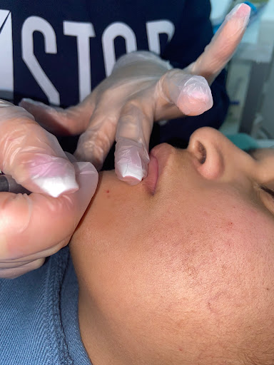 Explore reggae tattoo ideas, creative tattoo ideas in Forest Hills, available at Laser Hair Removal - Tattoo Removal