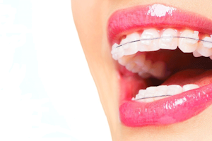 Clínica Dental Torrelodones - Dentista Adelaida Parra image
