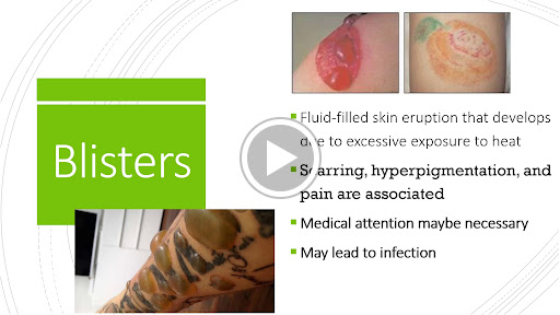 Explore elbow tattoo ideas traditional, creative tattoo ideas in Colorado Springs, available at Kryptonite Laser Professionals