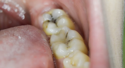 The Perfect Smile image