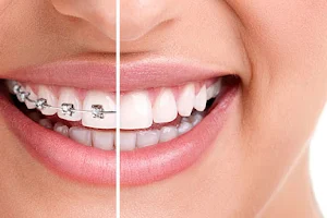 Japjee Family Dental Clinic | Dental Clinic in Mohali | Dental Implants image