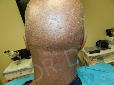Medical Hair Transplant & Aesthetics image