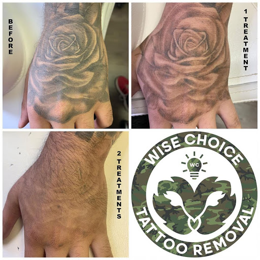 Explore tattoo ideas for the wrist females, creative tattoo ideas in Denver, available at Wise Choice Tattoo Removal
