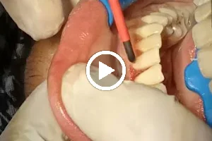 Shree Dental Care & Implant Center image