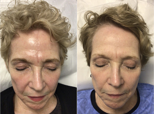 Explore egyptian tattoos ideas, creative tattoo ideas in Everett, available at Renew ND Medspa