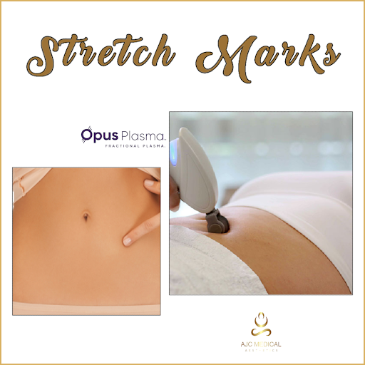 Explore space filling tattoo ideas, creative tattoo ideas in Raleigh, available at AJC Medical Aesthetics