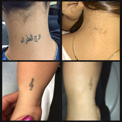 Explore ohio tattoo ideas, creative tattoo ideas in Middle Village, available at Bye Bye Ink Laser Tattoo Removal