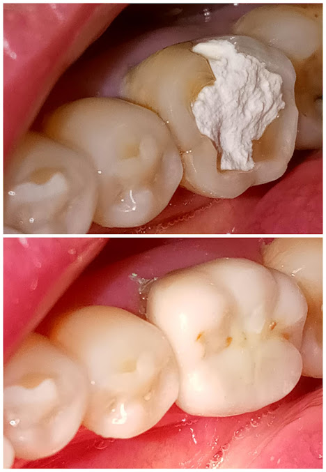 Dental 24/7 Emergencies - Dental 24/7 Emergencies