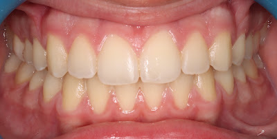 DR GUILLERMIN Anthony Louis - Orthodontie - Pratique réservée à l'orthodontie à Mantes-la-Jolie
