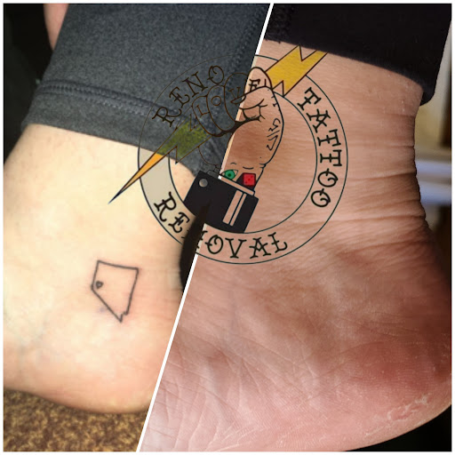 Explore 3d tattoo ideas for women, creative tattoo ideas in Reno, available at Reno Tattoo Removal