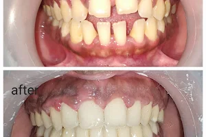 Dr. Ritu's Orthodontic, Dental & Implant Care (Invisalign specialist) image