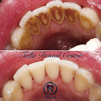 Talla Dental Centerمركز طله لطب وجراحه الفم والاسنان