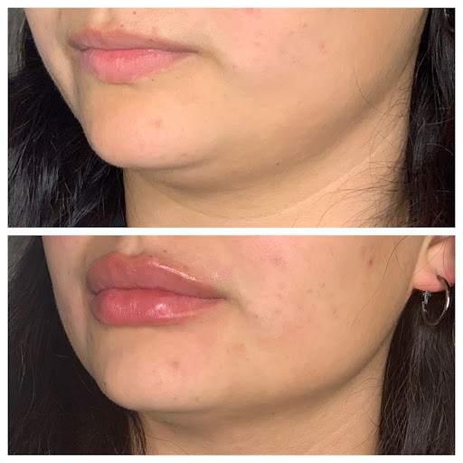 Explore hell tattoo ideas, creative tattoo ideas in Eugene, available at Brighter Smiles Med Spa and Laser Center