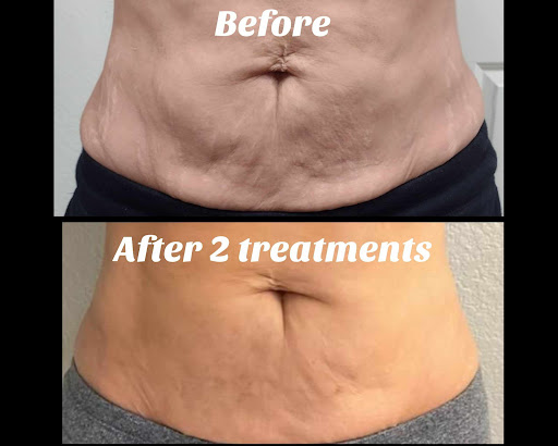 Explore arm sleeve tattoo ideas for females, creative tattoo ideas in Brighton, available at Tip of the Spear Laser Esthetics