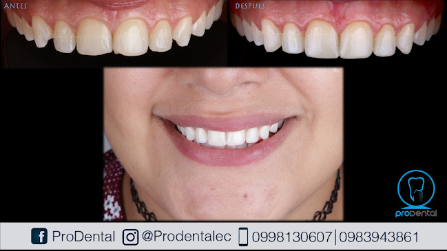 Opiniones de ProDental_Machala en Machala - Dentista