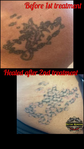 Explore carnation tattoo ideas, creative tattoo ideas in Fort Worth, available at Here 2Day Gone 2Morrow Tattoo Removal