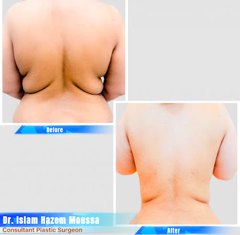 Dr. Hazem Mokhaimer - Dr. Hazem Mokhaimer