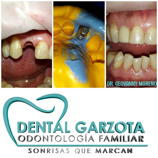 Dental Garzota Centro de Especialidades Odontológica