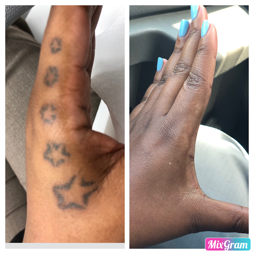 Explore small tattoo name ideas, creative tattoo ideas in Longview, available at Vanish Laser Aesthetics