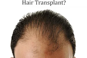 Auqual Hair Services - Hair Transplant in Raipur at best Cost, FUE FUT PRP, Hair Clinic Raipur image