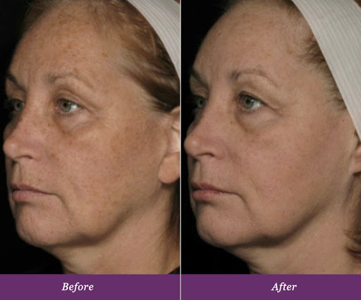 Day Spa «Polished Salon, Spa & Wellness», reviews and photos, 1200 Market St #220, Lemoyne, PA 17043, USA