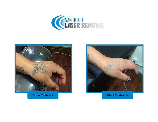 Explore tattoo ideas for mens, creative tattoo ideas in San Diego, available at Removery Tattoo Removal & Fading