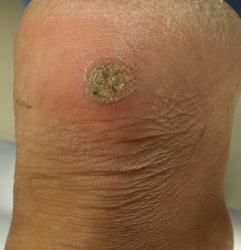 Orange County Podiatry image