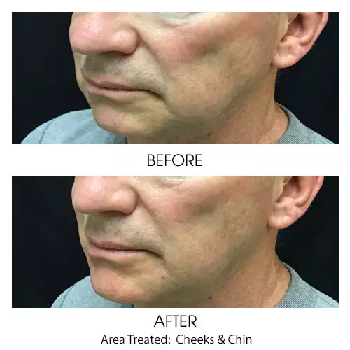 Find scorpion tattoo ideas for your next unique tattoo in York at Lbo Aesthetics & Spa - York, PA