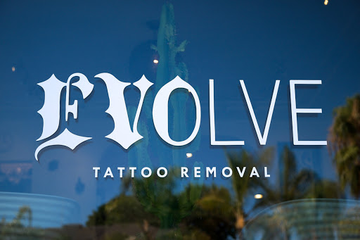 Find best friends tattoo ideas for your next unique tattoo in San Diego at Evolve Tattoo Removal