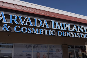 Arvada Implants and Cosmetic Dentistry image