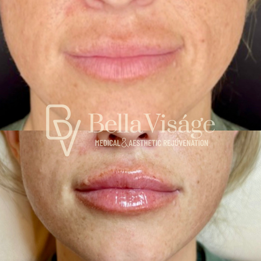 Explore womens shoulder tattoo ideas, creative tattoo ideas in Lakeland, available at Bella Visge Medical & Aesthetic Rejuvenation