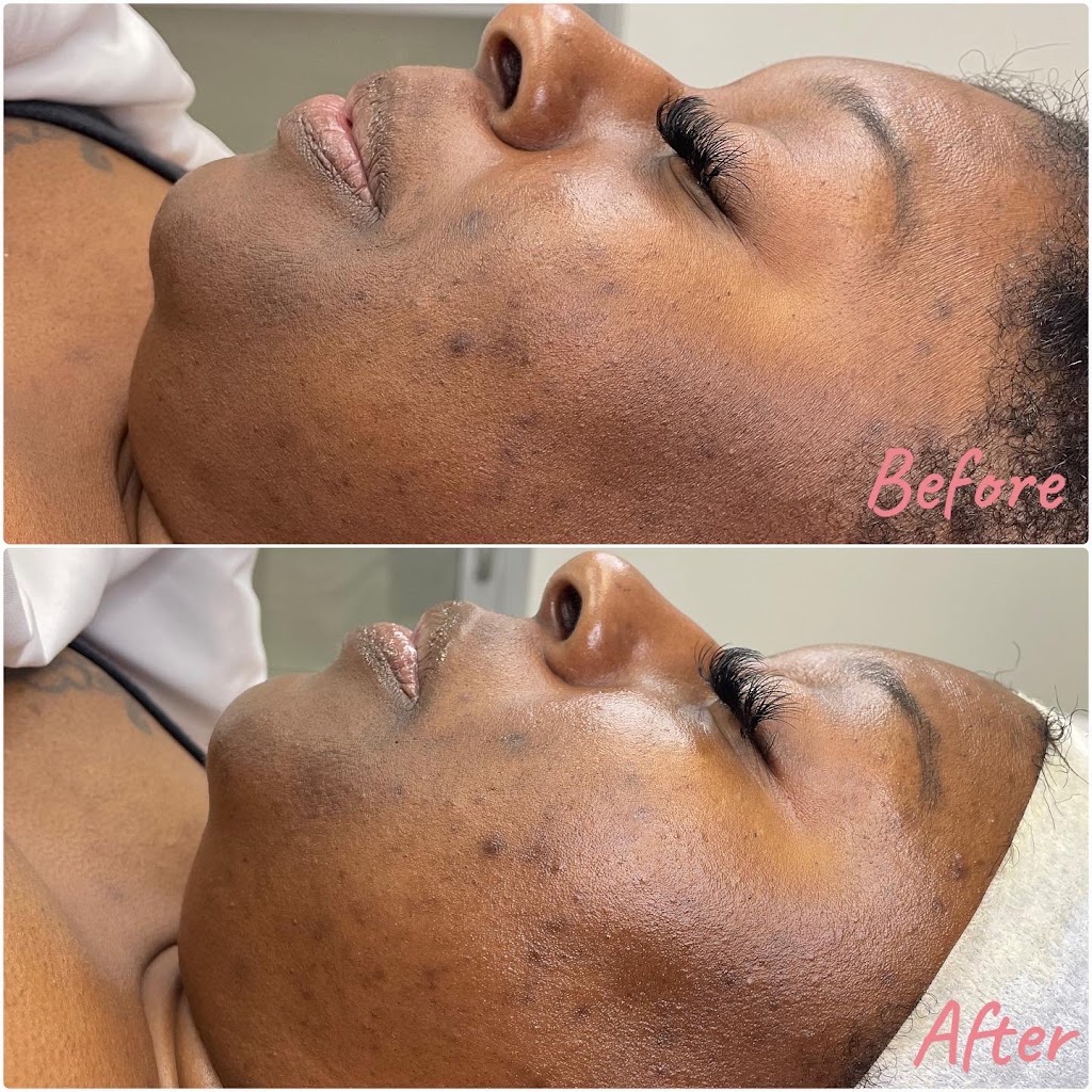 RoyalT Esthetics 95112
