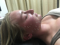 LIFE & NATURE - ACUPUNCTURE AND HOLISTIC MEDICINE - Photo 5 - Car repair in Anaheim, CA, Garden Grove