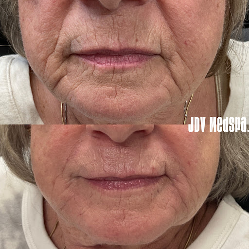 Explore knuckle tattoo ideas male, creative tattoo ideas in Canton, available at JDV Med Spa