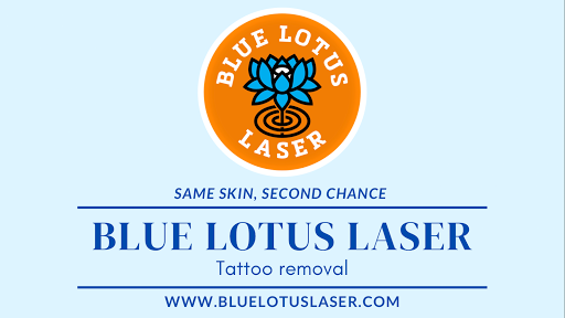 Blue Lotus Laser