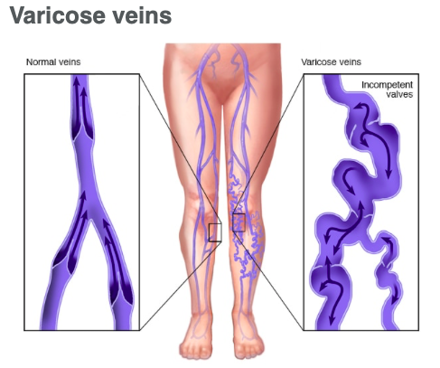 Explore evil eye tattoo ideas, creative tattoo ideas in Lake Oswego, available at Lake Oswego Vein and Aesthetic LOVA