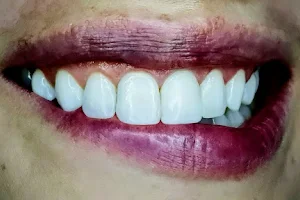 Bocca Dental Clinics image