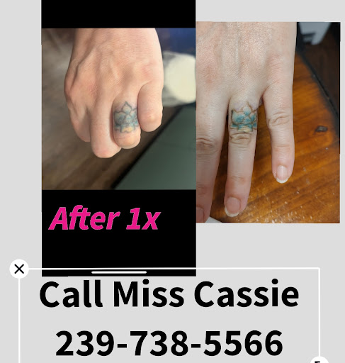 Explore volleyball tattoo ideas, creative tattoo ideas in Fort Myers, available at Miss Cassies laser tattoo removal