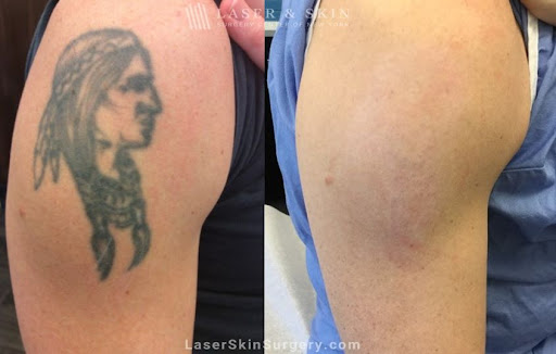 Discover pinterest tattoo ideas for guys designs for your next tattoo in Southampton at Laser & Skin Surgery Center of New York - Southampton