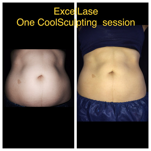 Explore tattoo leg ideas, creative tattoo ideas in Raleigh, available at ExcelLase