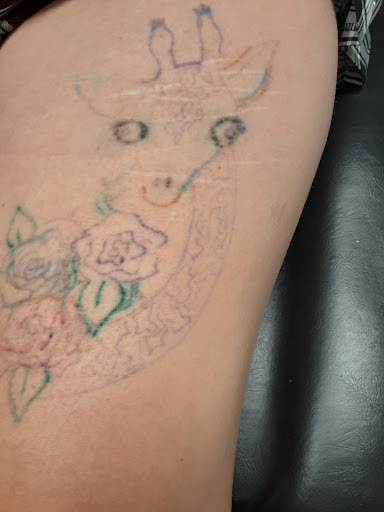 Explore initial tattoo ideas for guys, creative tattoo ideas in Saint Paul, available at Fearless Tattoo Removal