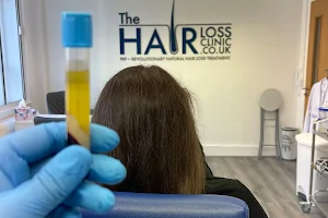 The Hair Loss Clinic | PRP Injections £175* | Microneedling image