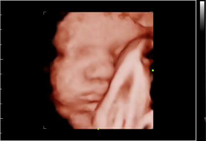 Pregnancy Treasures & Boutique (3D4D ultrasounds)