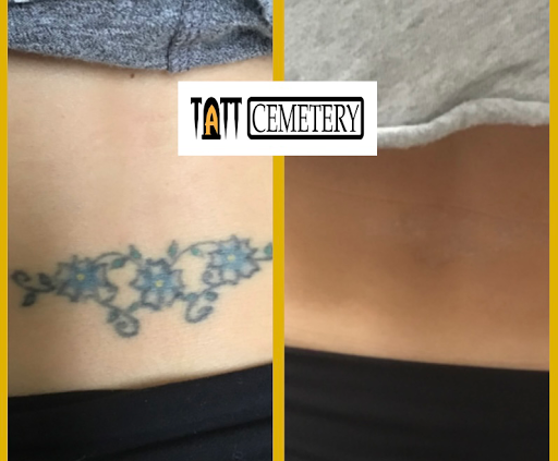 Explore travis scott tattoo ideas, creative tattoo ideas in Fort Myers, available at Laser Tattoo Removal by Tatt Cemetery