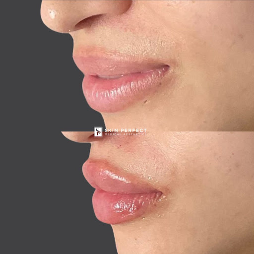 Explore microphone tattoo ideas, creative tattoo ideas in Whittier, available at Skin Perfect Medical Aesthetics